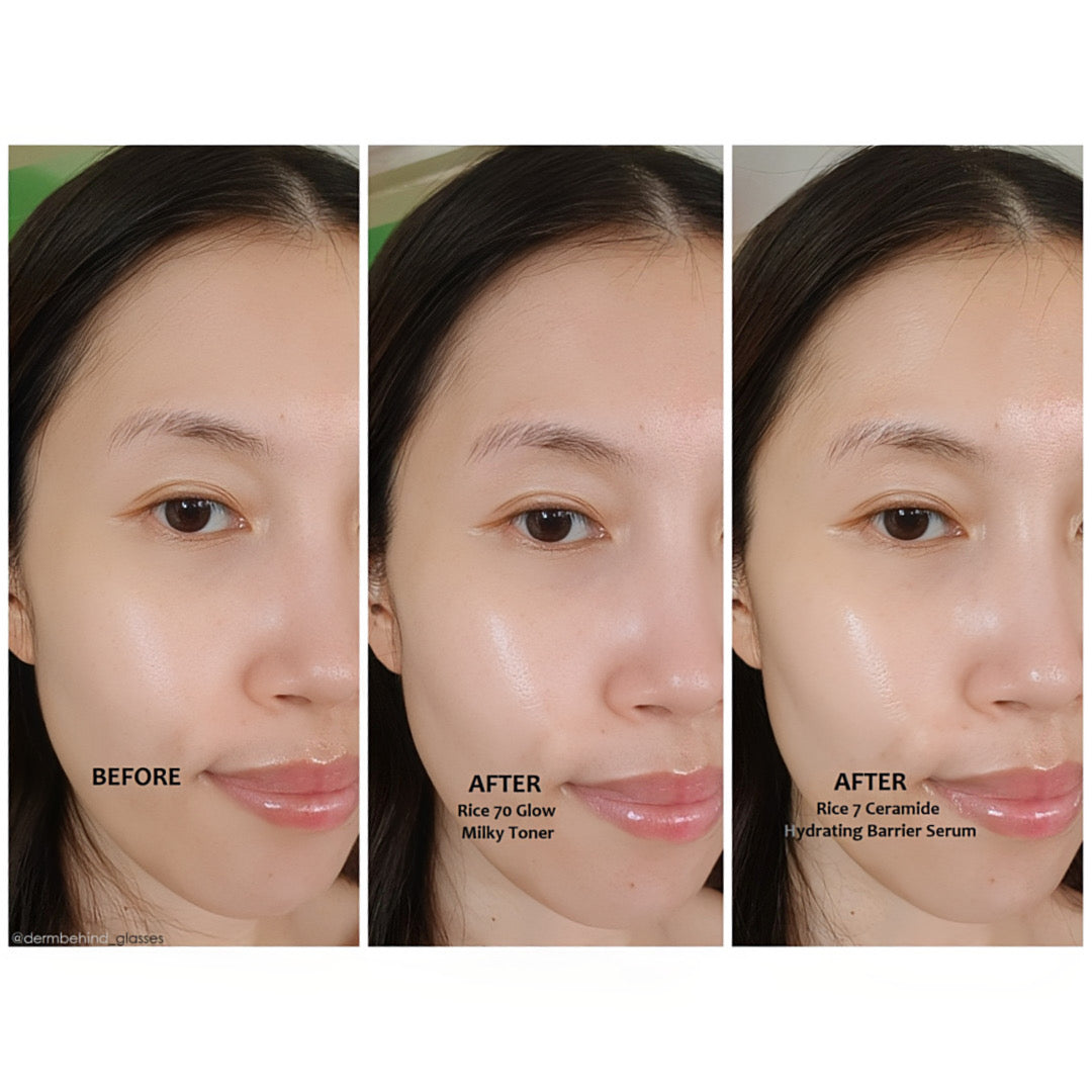 Anua 7 Rice Ceramide Hydrating Barrier Serum 50ml